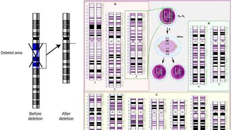 Deletion Mutation Definition Causes Mechanism Examples Biology