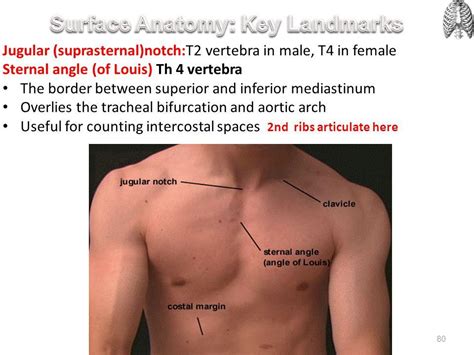 Counting Intercostal Spaces