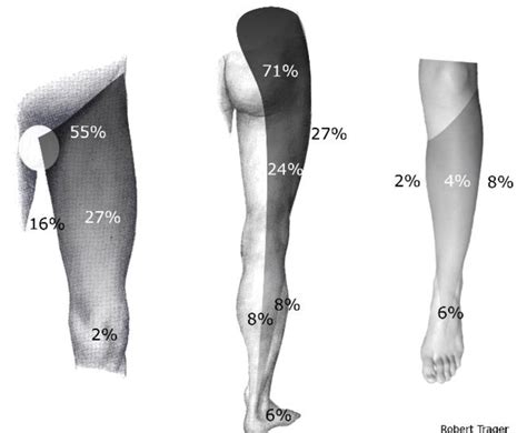 Hip Joint Pain Referral Patterns Image By Robert Trager Dc Based On