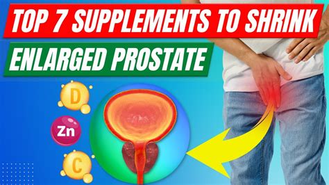 Top 7 Supplements To Shrink An Enlarged Prostate Youtube