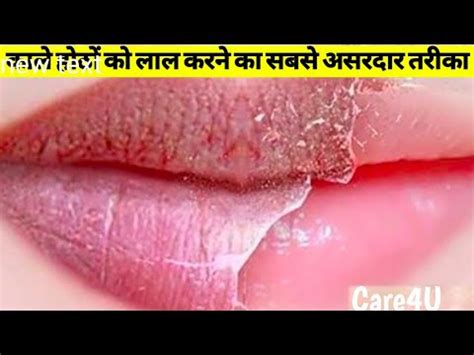 Lips Red Karne Ke Upay In Hindi Lipstutorial Org