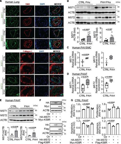 Noncanonical HIPPO MST Signaling Via BUB3 And FOXO Drives Pulmonary