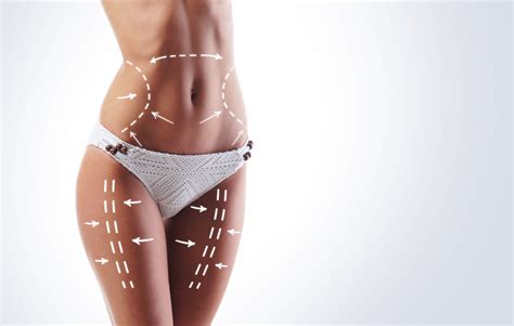 Liposuction Recovery A Week By Week Guide Omaha Liposuction By Imagen