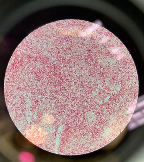 Solved Endospore Stain Positive Or Negativeendospore Stain Chegg