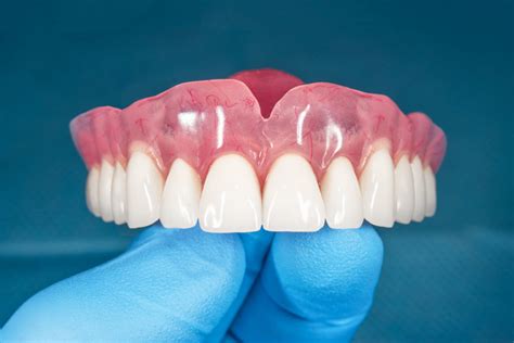 Dentures Ismile Dental