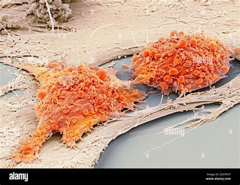 Mesenchymale Stammzellen Farbige Scanning Electron Micrograph SEM