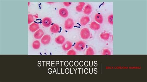 Streptococcus Gallolyticuspptx