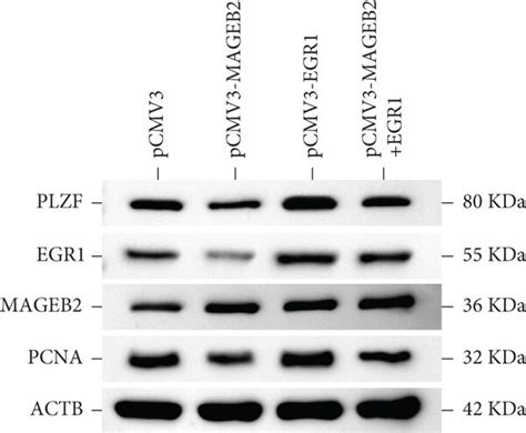 Rescue Effects Of EGR1 On The Proliferation Of MAGEB2 Overexpressed SSC