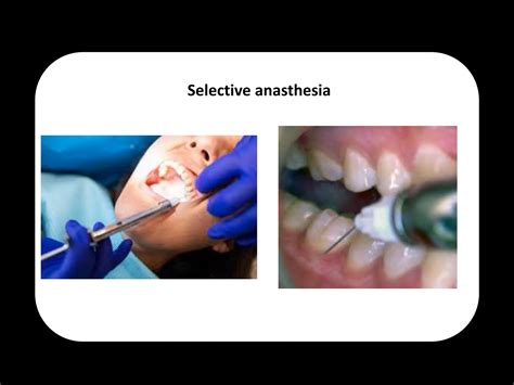 Endodontic Diagnosis. first part in diagnosispptx | PPTX