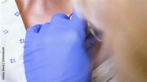 Doctor Examining Birthmarks And Moles Patient Examination Of