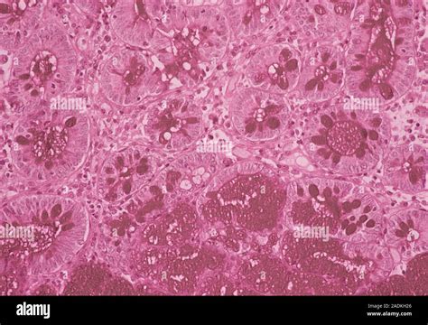 Small Intestine Lining Light Micrograph Of A Cross Section Through The Healthy Lining Of A