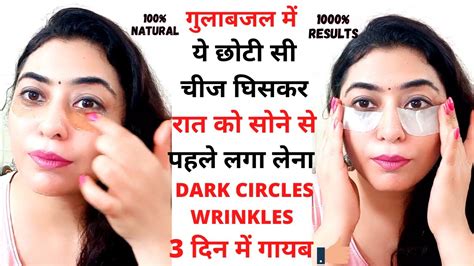 Dark Circles Kaise Hataye आखों के काले घेरे हटाने के घरेलू नुस्खे