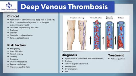 Deep Venous Thrombosis Dvt Diagnosis And Optimal Treatment Scope