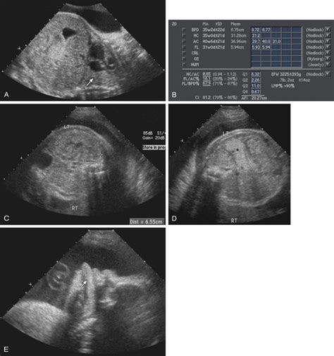 Obstetric Ultrasound Examination Radiology Key