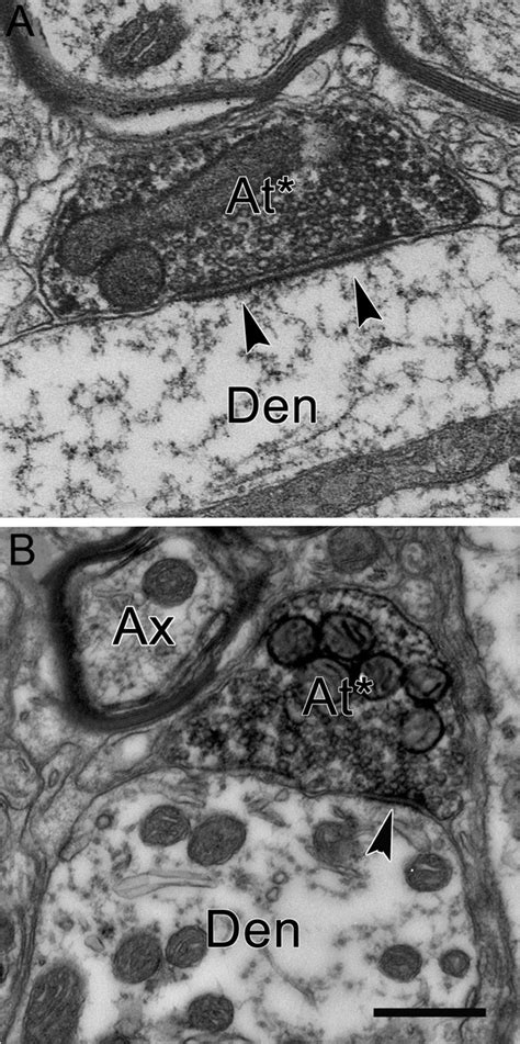 Electron Micrographs Of Axon Terminals In Rip Labeled From A Bda