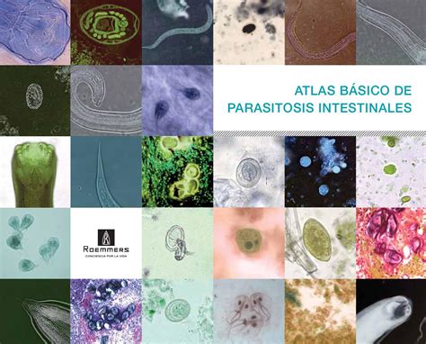 Parasitosis Atlas by Ec t Ediciones Científico técnicas Issuu