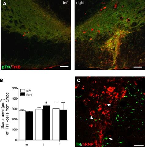 In Vivo Effect Of BDNF Secreting HMSCs Into The Intact SNpc 1 Week