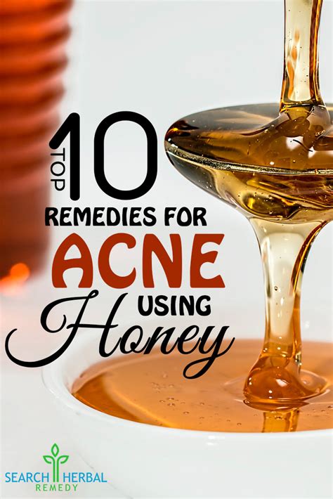 Top 10 Remedies For Acne Using Honey | Search Herbal & Home Remedy