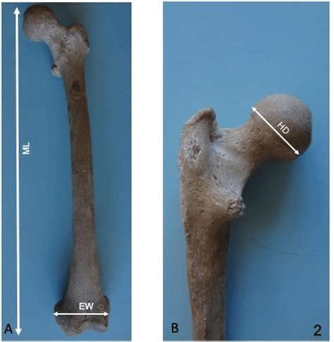 Human femur bone with measured areas. A: ML-maximum length ...