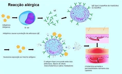 Sintomas Da Alergia Ao N Quel Gram Neas Alimentos E Carofisioterapia