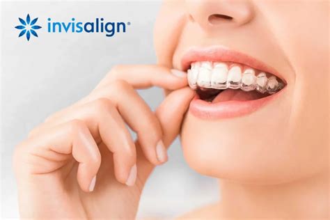 จัดฟันแบบใส Invisalign คืออะไร ดีไหม ราคาเท่าไหร่ [ รีวิวจากทันตแพทย์ ]