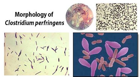 Clostridium Species Gram Stain