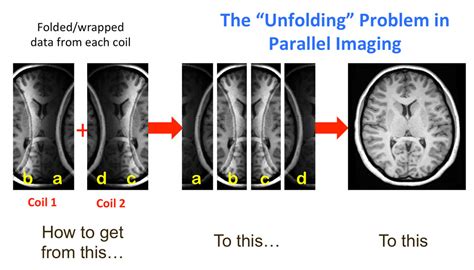 Parallel Imaging Pi Questions And Answers In Mri