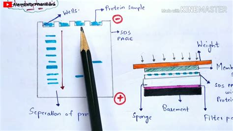 Western Blotting Technique Detection Of Proteins Principle