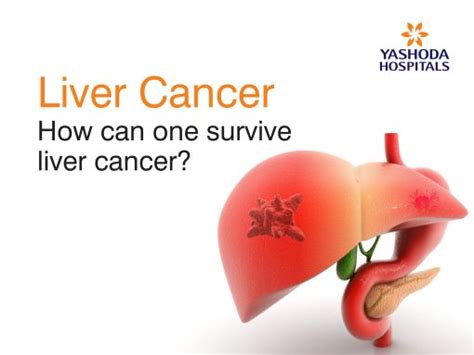 How Can One Survive Liver Cancer Liver Cancer Treatment In Hyderabad Or Can You Survive