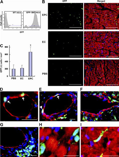 EPC Transplantation Augments Incorporation Of BM Derived Cells Into