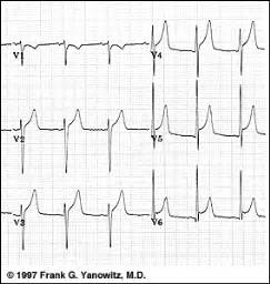 ECG Learning Center - An introduction to clinical electrocardiography