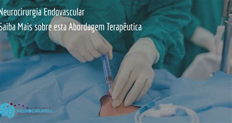 Tudo Sobre Cirurgia De Aneurismas Cerebrais Dr Victor Barboza