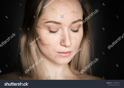 Woman Cracked Skin Cosmetic Dehydration Effect Stock Photo 1149383312 | Shutterstock