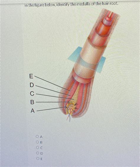 Solved In the figure below, identify the medulla of the hair | Chegg.com