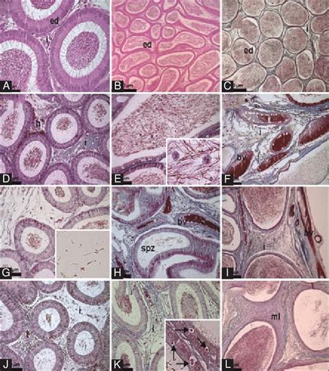 Photomicrographs Of Epididymis In The Rats Of Groups Co A C C20