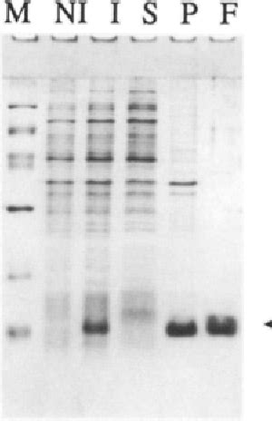 Figure 4 From The Major Myosin Binding Domain Of Skeletal Muscle MyBP C