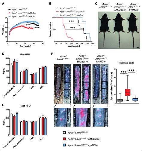 Vascular Smooth Muscle Cell VSMC Specific Progerin Expression In