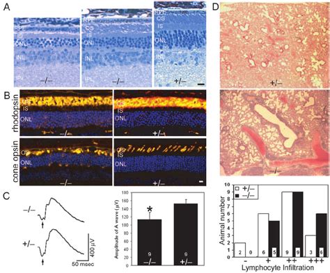 Retinal Degeneration And Lung Lymphocyte Infiltration In The Rootletin