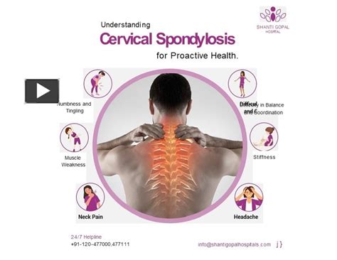 Ppt Proactive Health Management Understanding Cervical Spondylosis At Multispeciality