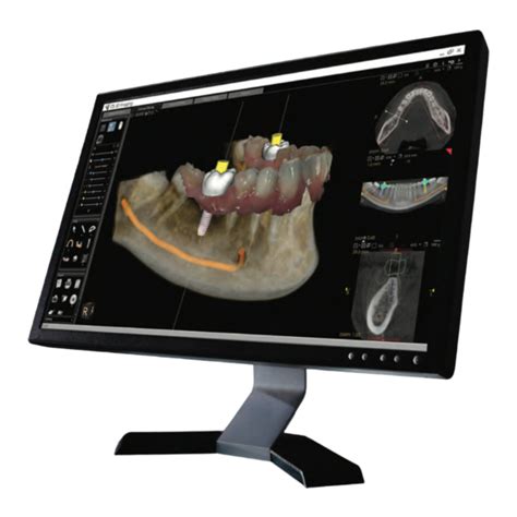 CARESTREAM DENTAL CS 3D IMAGING GUIDE D UTILISATION Télécharger le Pdf