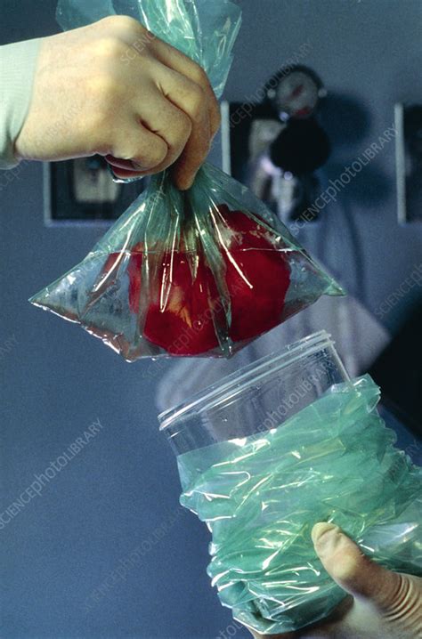 Kidney transplant: arrival of donor kidney - Stock Image - M575/0012 ...