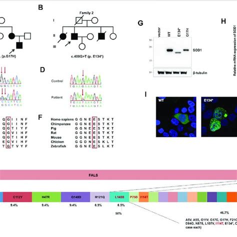 Sod Novel Variants Identified In Patients Functional Study And