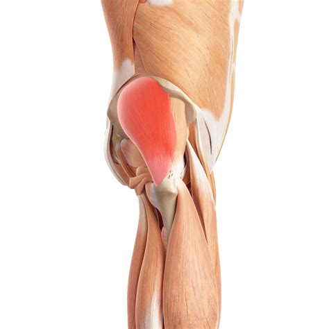 Gluteus Medius Tears – Hip Preservation Institute