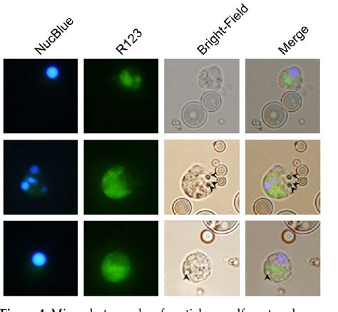 Figure From The Acute Immune Responses Of The Common Carp Cyprinus