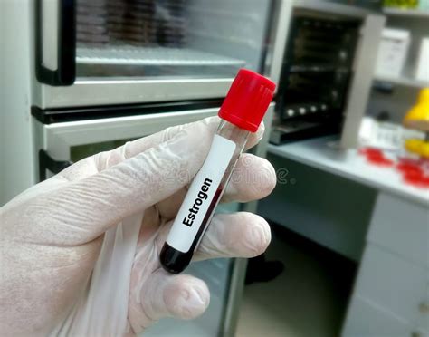 Blood Sample For Estrogen Hormone Test Female Sex Hormone Estradiol