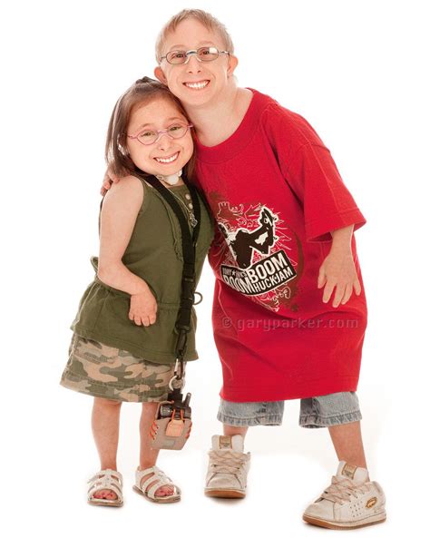 pin  primordial dwarfism