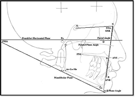 E Showing Cephalometric Hard Tissue Angular And Linear Measurements Download Scientific Diagram