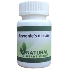 Natural Herbs Clinic - Natural Herbal Remedies For Peyronie's disease