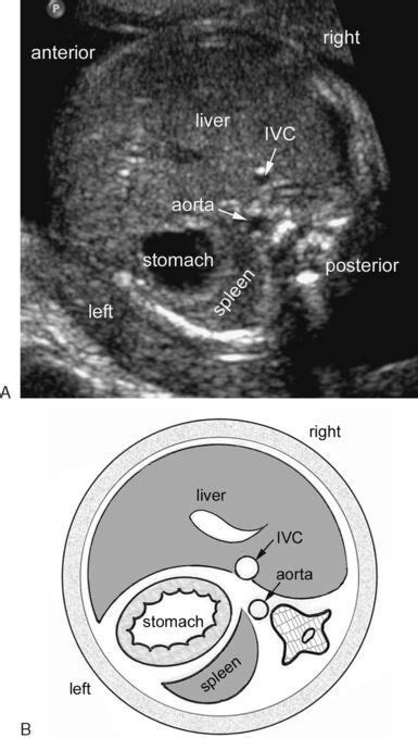 Pin On Ultrasound