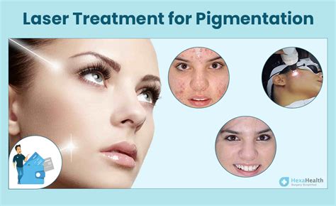 Laser Treatment for Pigmentation in India - Cost & Results